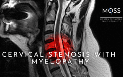 CERVICAL STENOSIS WITH MYELOPATHY