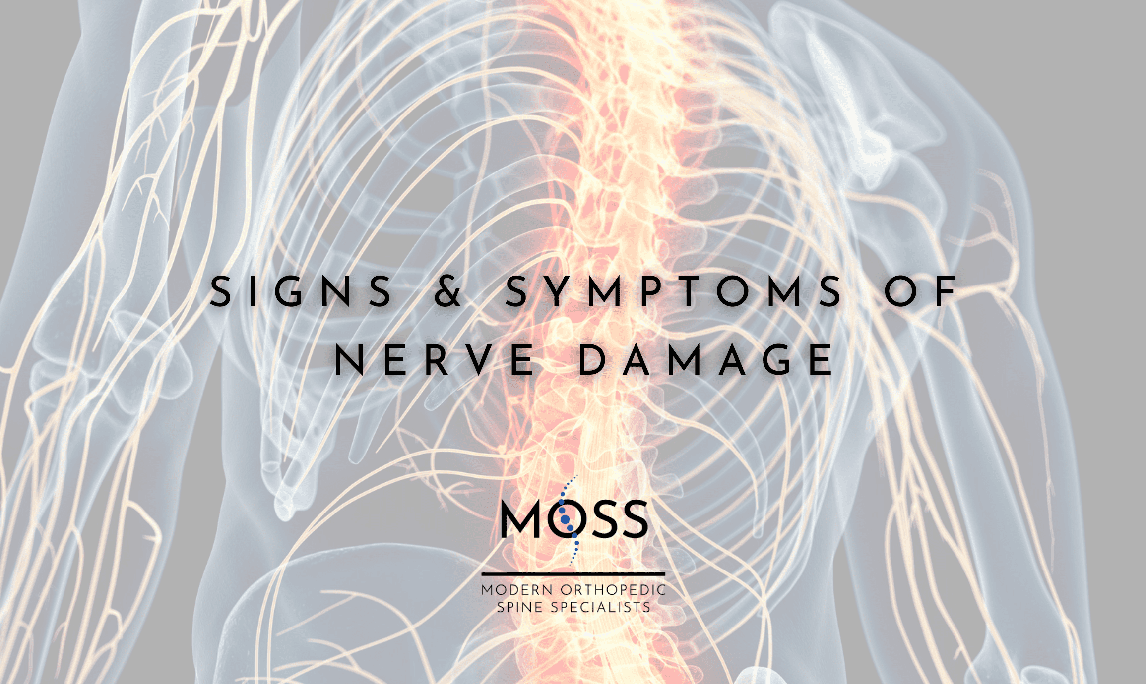 Signs & Symptoms of Nerve Damage Modern Orthopedic Spine Specialists